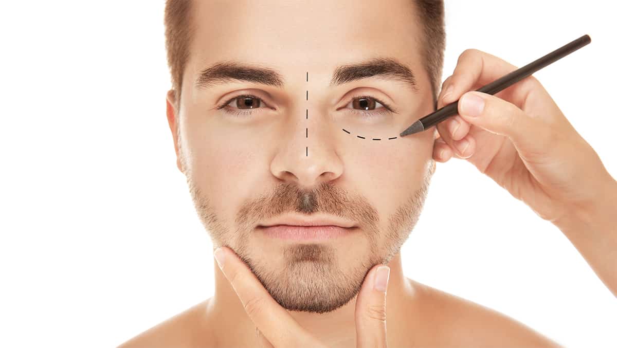 Ojeras en hombres